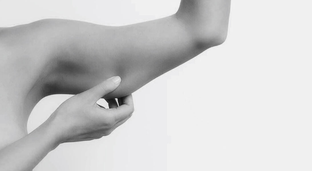 arm lift surgery houston