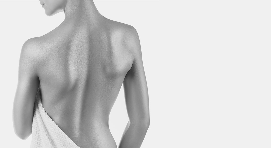 belt lipectomy surgery houston