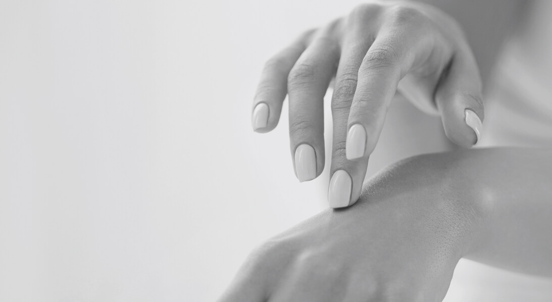 hands chemical peel houston