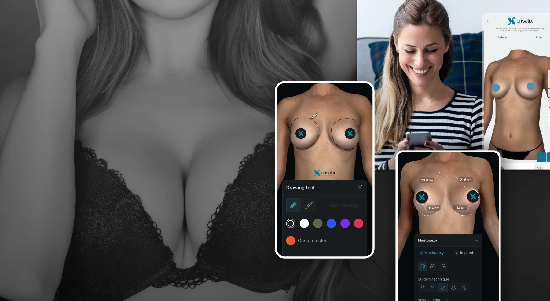 Natrelle 3D Breast Visualizer Banner