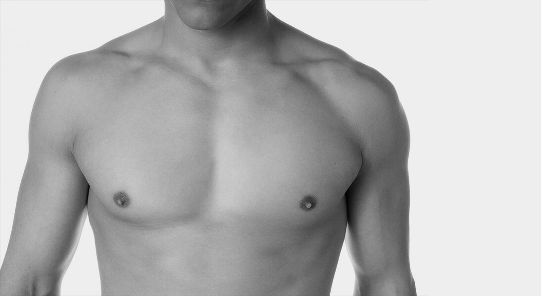 pec implants houston
