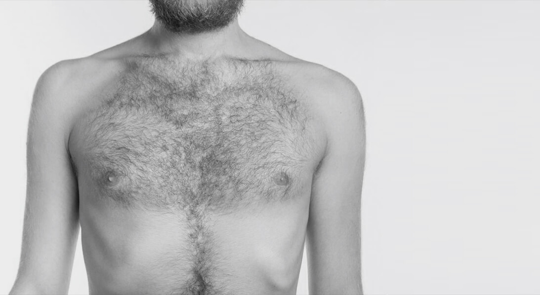 pec implants for men houston