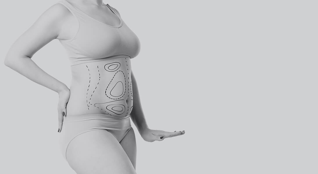 weight loss surgery houston